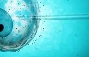 卵巢囊肿的起因是什么？为什么会出现卵巢囊肿？