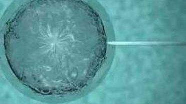 40岁高龄女人做试管注意自身生理条件，心理准备也很重要